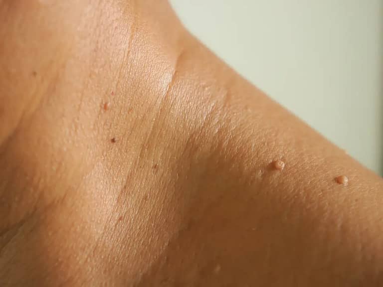 Vale Laser Aesthetics photo 4