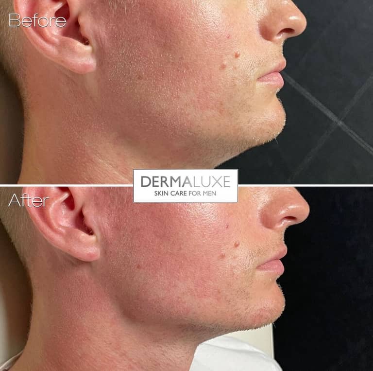 DermaLuxe Aesthetics photo 3
