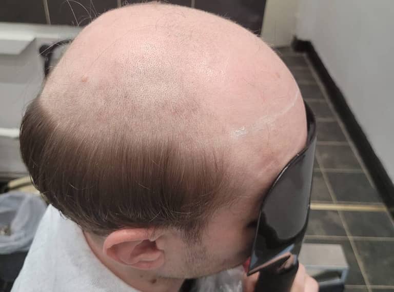 Elite 9 Hair Clinic photo 2