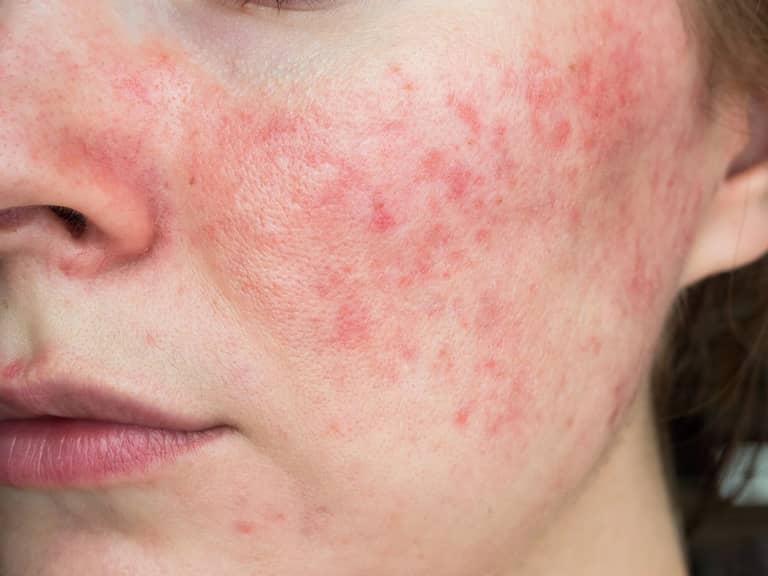 Leonie Thorne Skin Studio