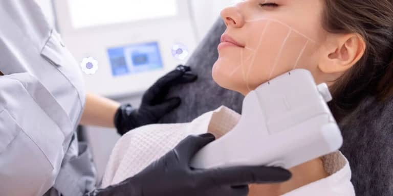 HIFU Facelift photo 3